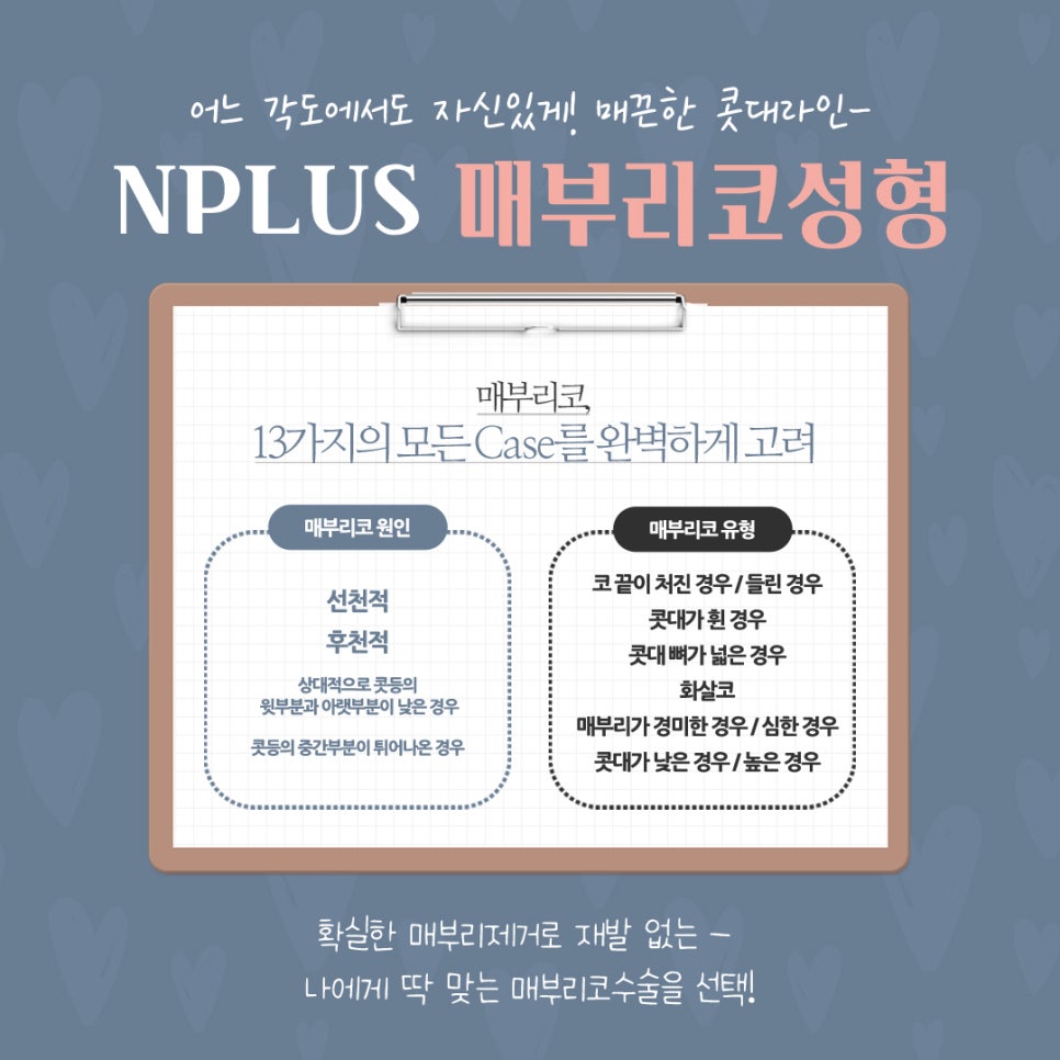 매부리코수술 후기까지 확인하고 관련 이미지 7