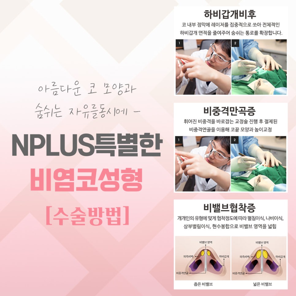 비염수술후기에 대한 정보를 알아보고 관련 이미지 8
