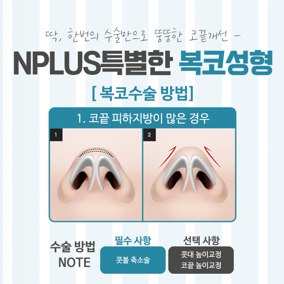 Looking Closely at Bulbous Nose Surgery Reviews image 8