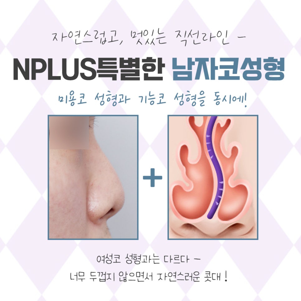 남자코성형후기 자세하게 알아보고 관련 이미지 5