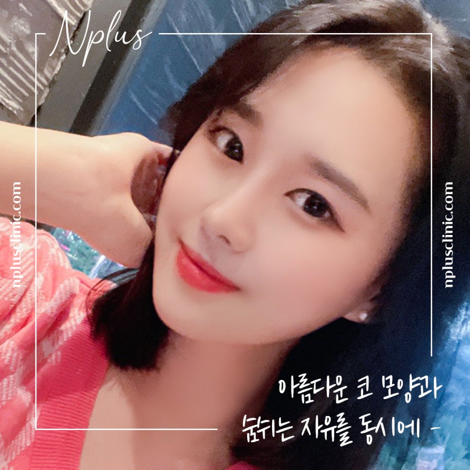 콧볼축소수술 후기까지 확인하고 결정 관련 이미지 2