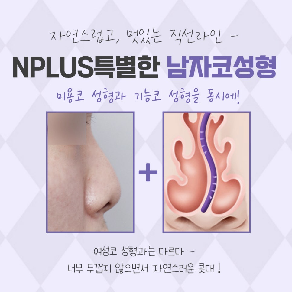 남자성형 자연스럽고 멋있게 관련 이미지 3