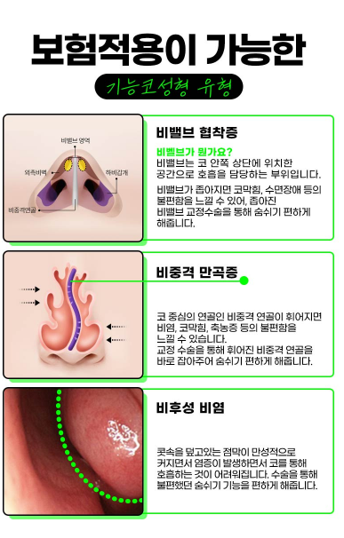 앤플러스에서 진행하는 기능코성형 EVENT 관련 이미지 5