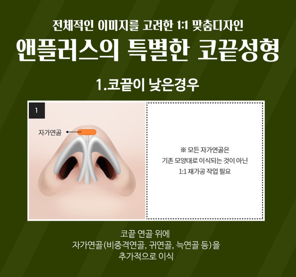 강남코성형 예쁜 코끝성형으로 이미지 개선 관련 이미지 5