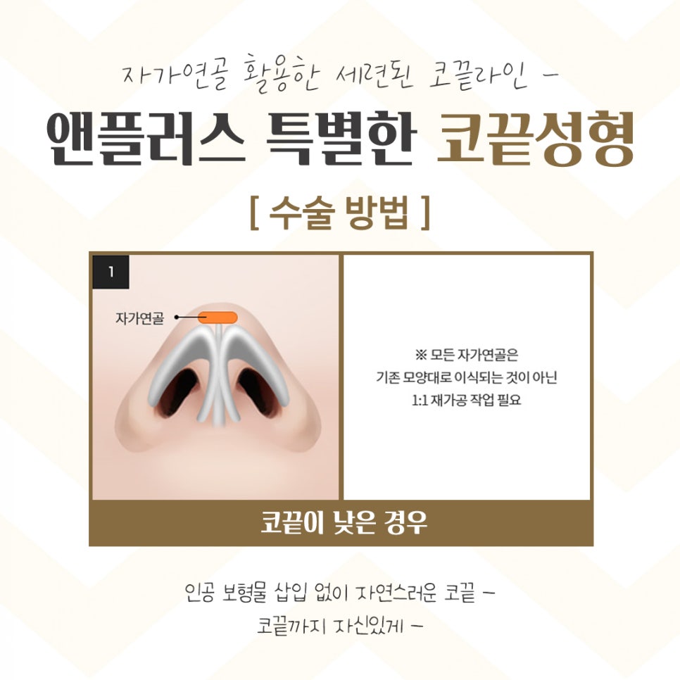 코끝수술후기 다양한 정보를 알아보고 관련 이미지 6