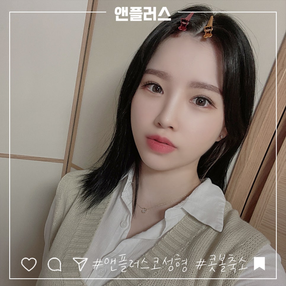 콧볼축소수술 흉터 없이 자연스럽게 관련 이미지 1