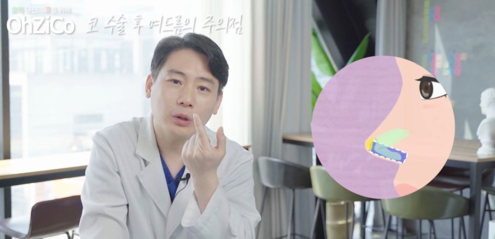 코수술후 코여드름 원인과 해결 방법 관련 이미지 17