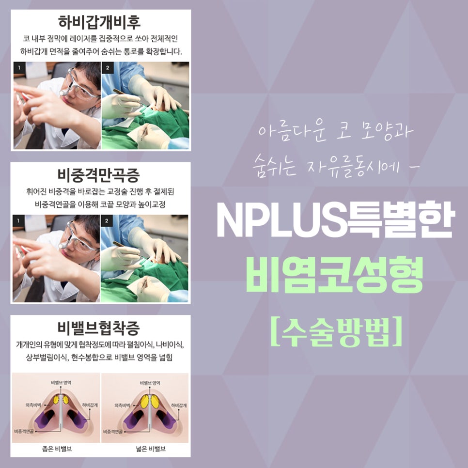 Rhinitis Surgery Review Based on an Accurate Diagnosis image 8