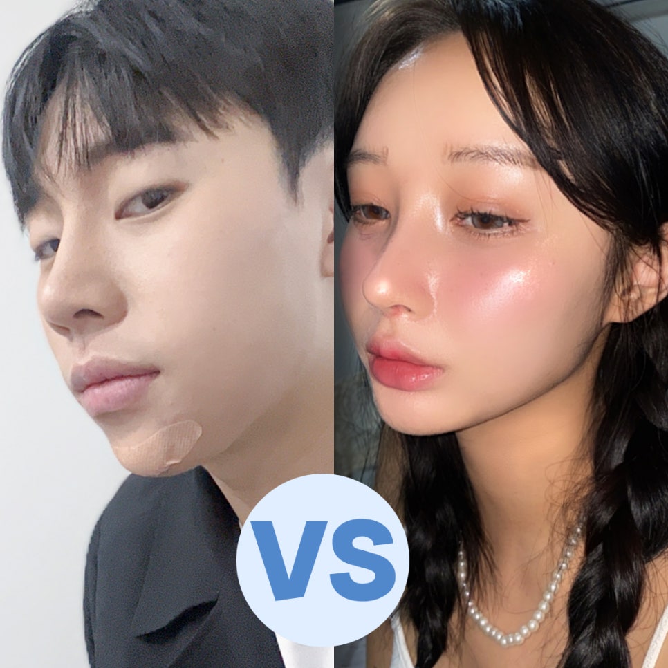 남자코성형전후 비교해 보고 관련 이미지 9