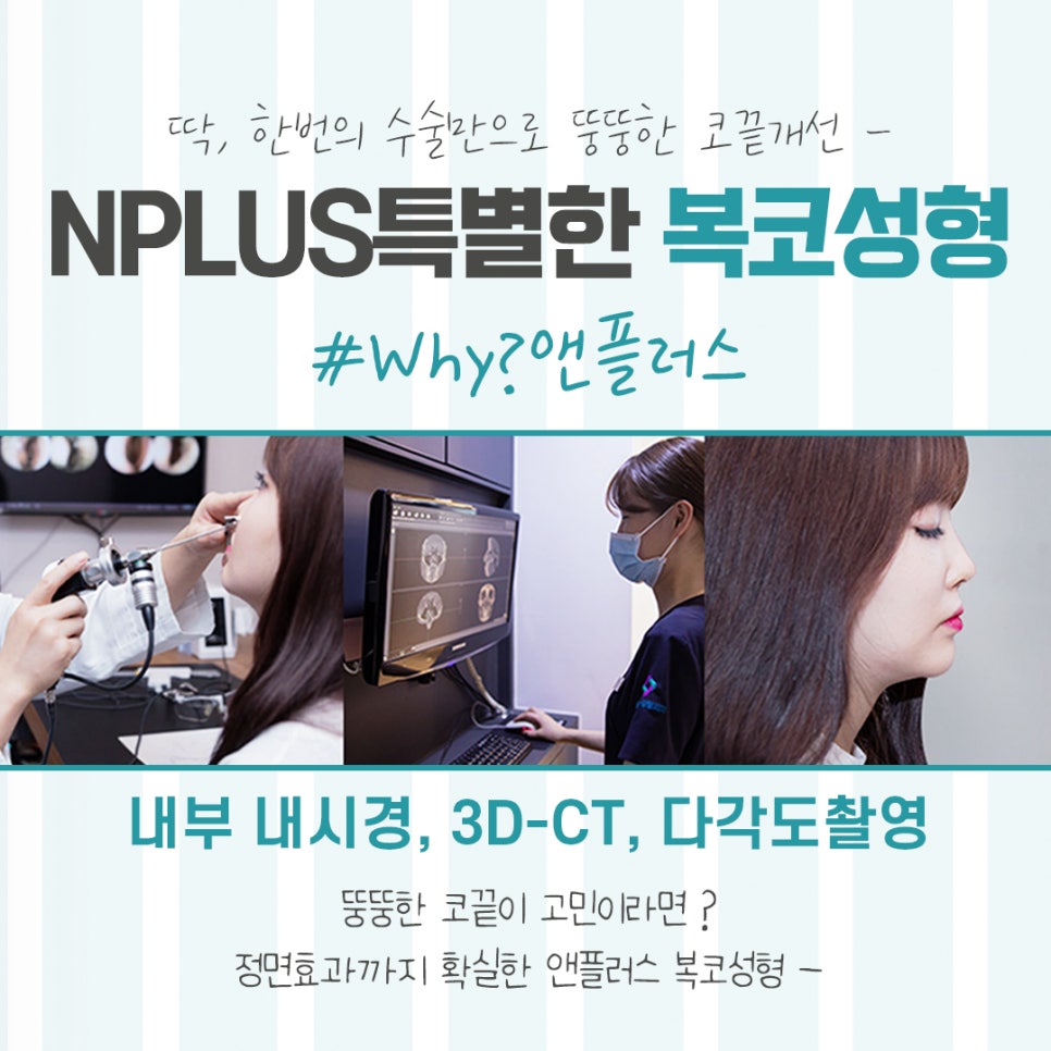 복코수술전후 확실한 차이를 알아보고 관련 이미지 12