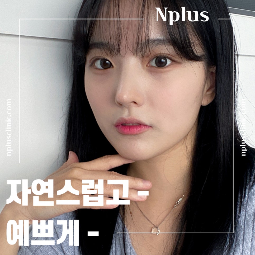 Nose Surgery Review with a Natural Nose Line image 13