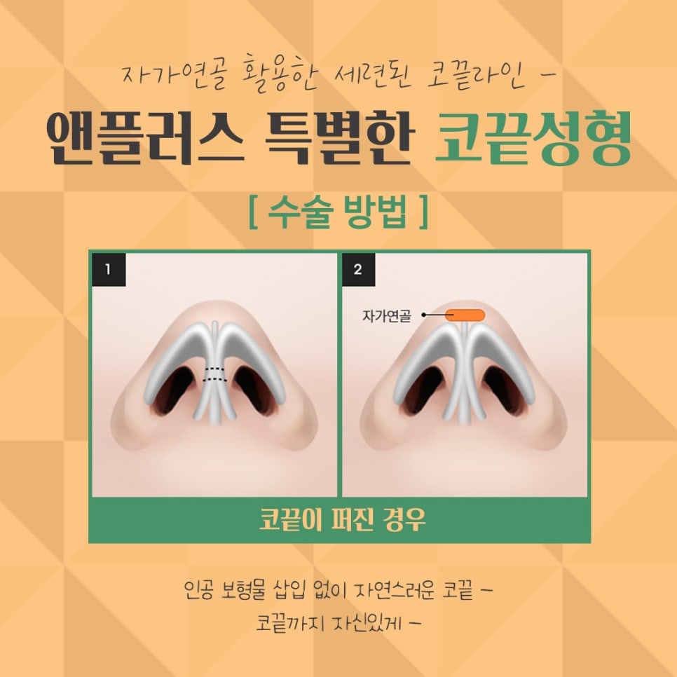 Nose Tip Surgery Review Found at Gangnam & Plus image 11