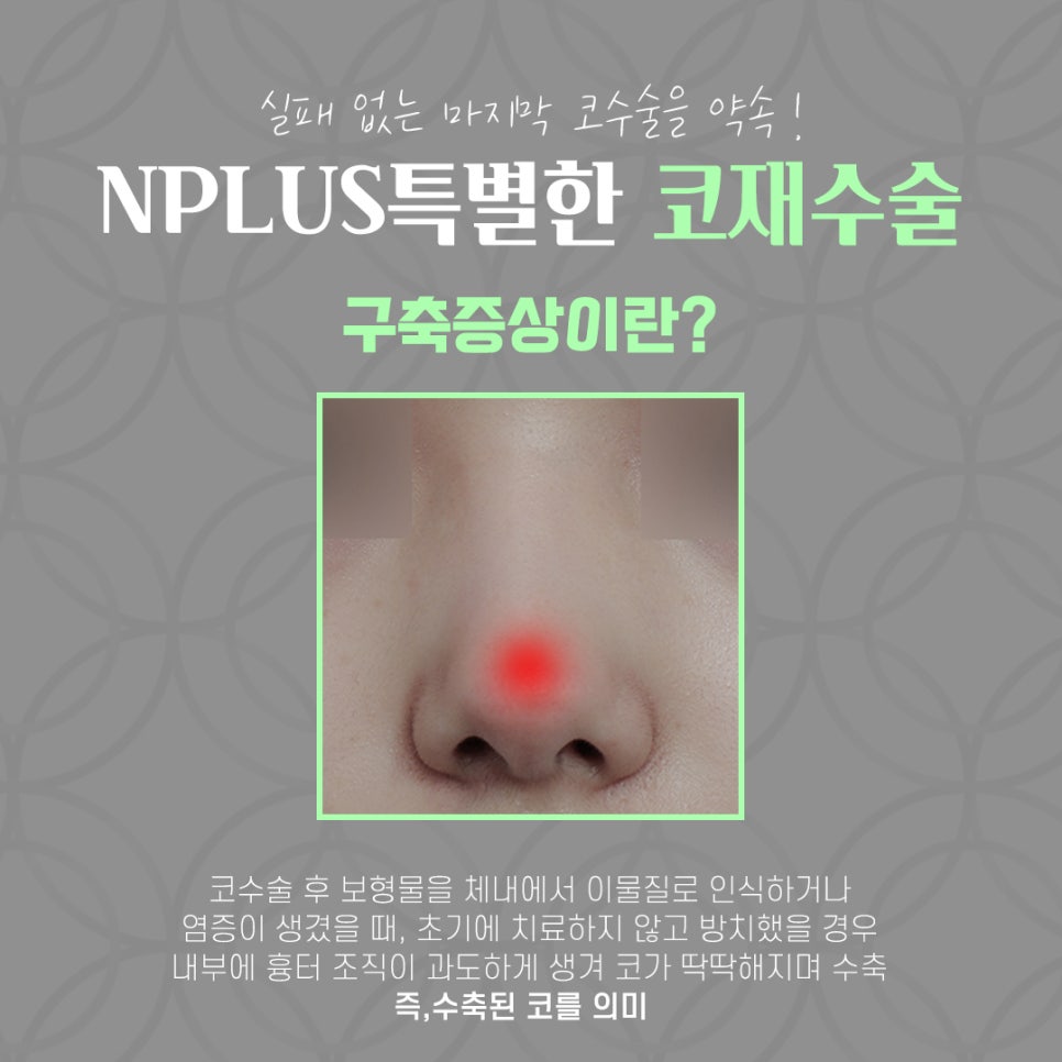코재수술후기 확실하게 진단하여 관련 이미지 5