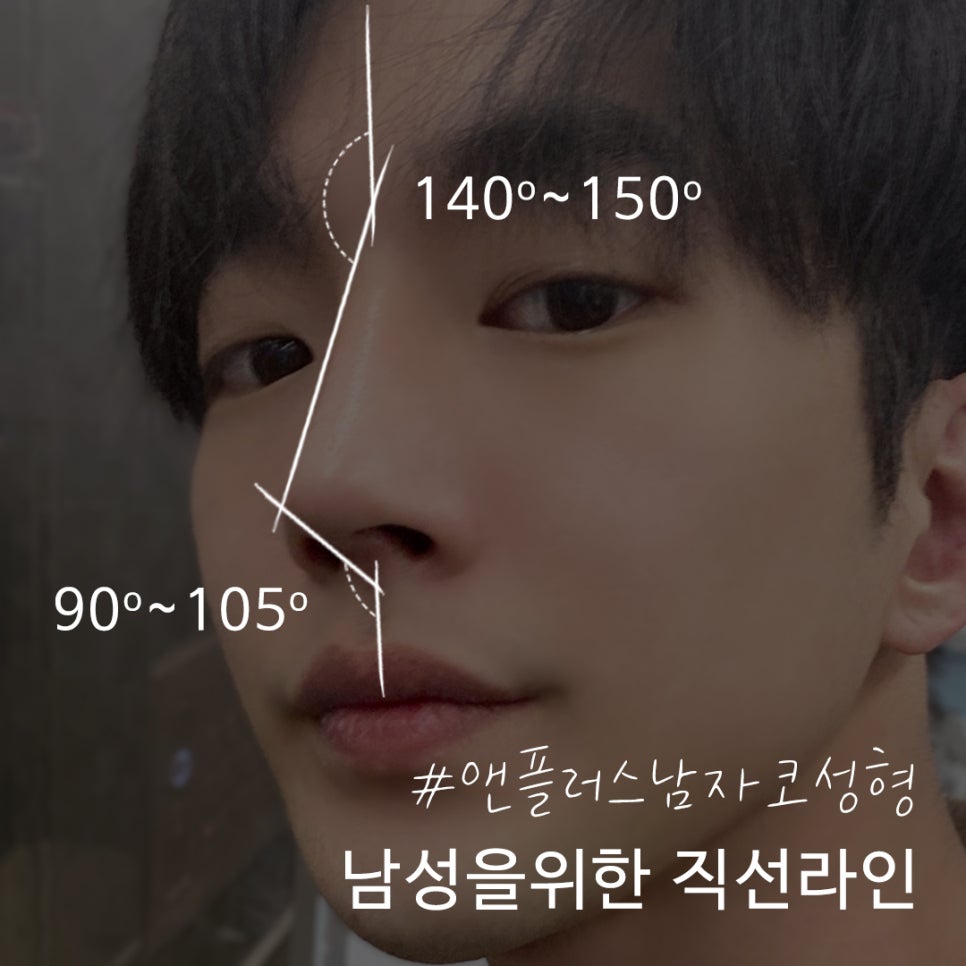 남자코성형 직선라인으로 남자답게 관련 이미지 6