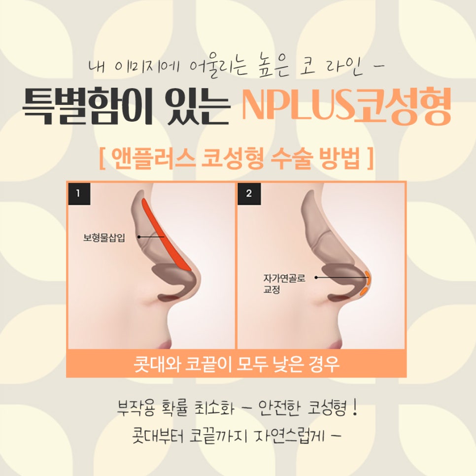 Looking into Reviews of Female Rhinoplasty in Detail image 8