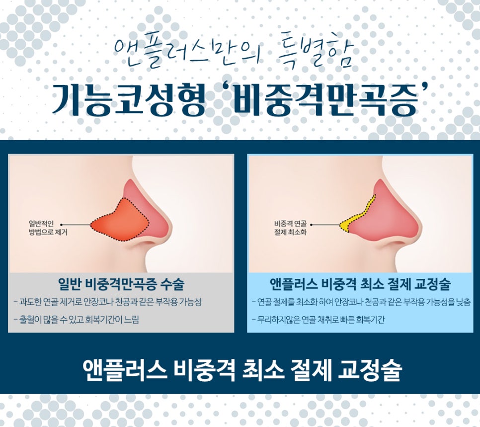 Septoplasty for Satisfying Results image 7