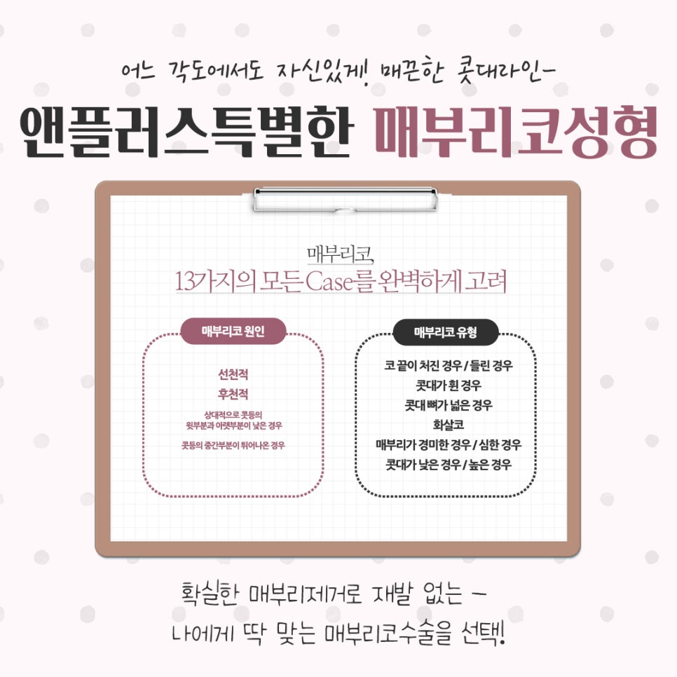 매부리코성형후기 꼼꼼하게 알아보고 관련 이미지 5