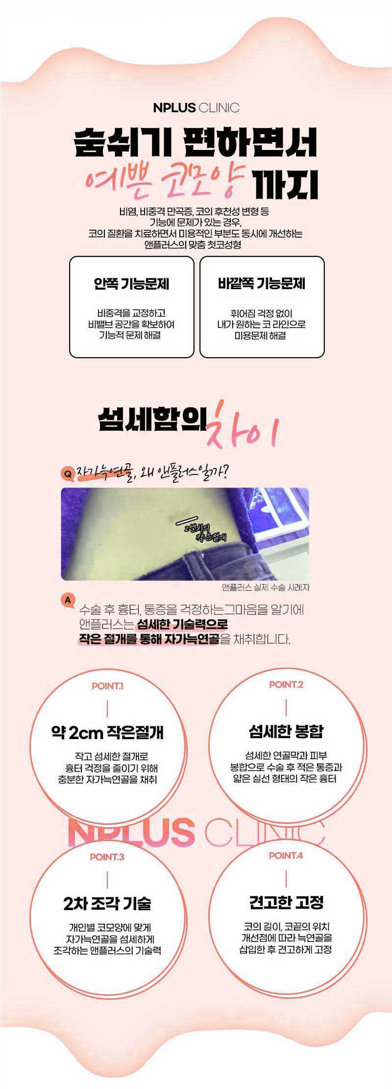 자가늑연골코성형비용에 대해 알아본다면?! 관련 이미지 7