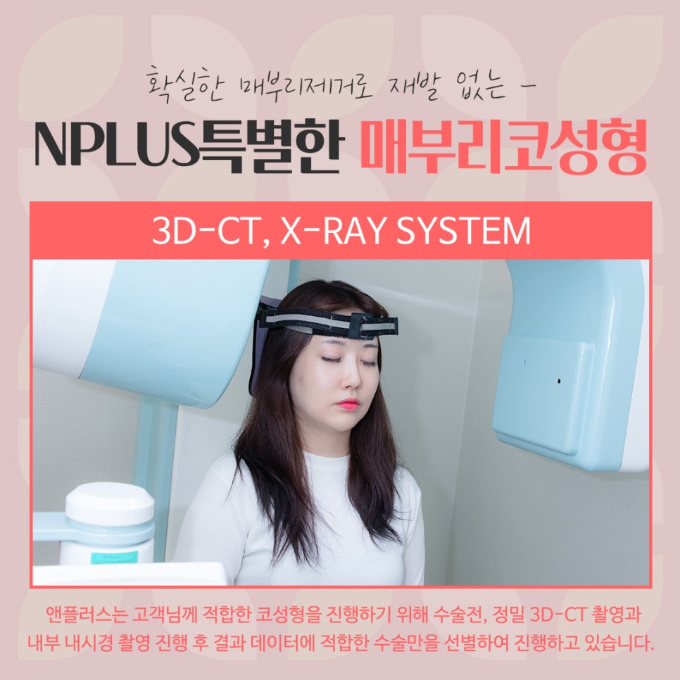 매부리코수술후기 자세하게 알아봐야 관련 이미지 7
