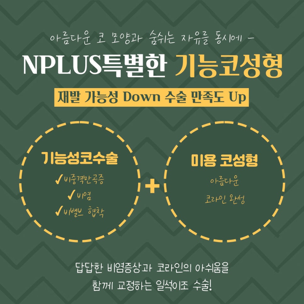 기능코성형후기 꼼꼼하게 알아보고 관련 이미지 8