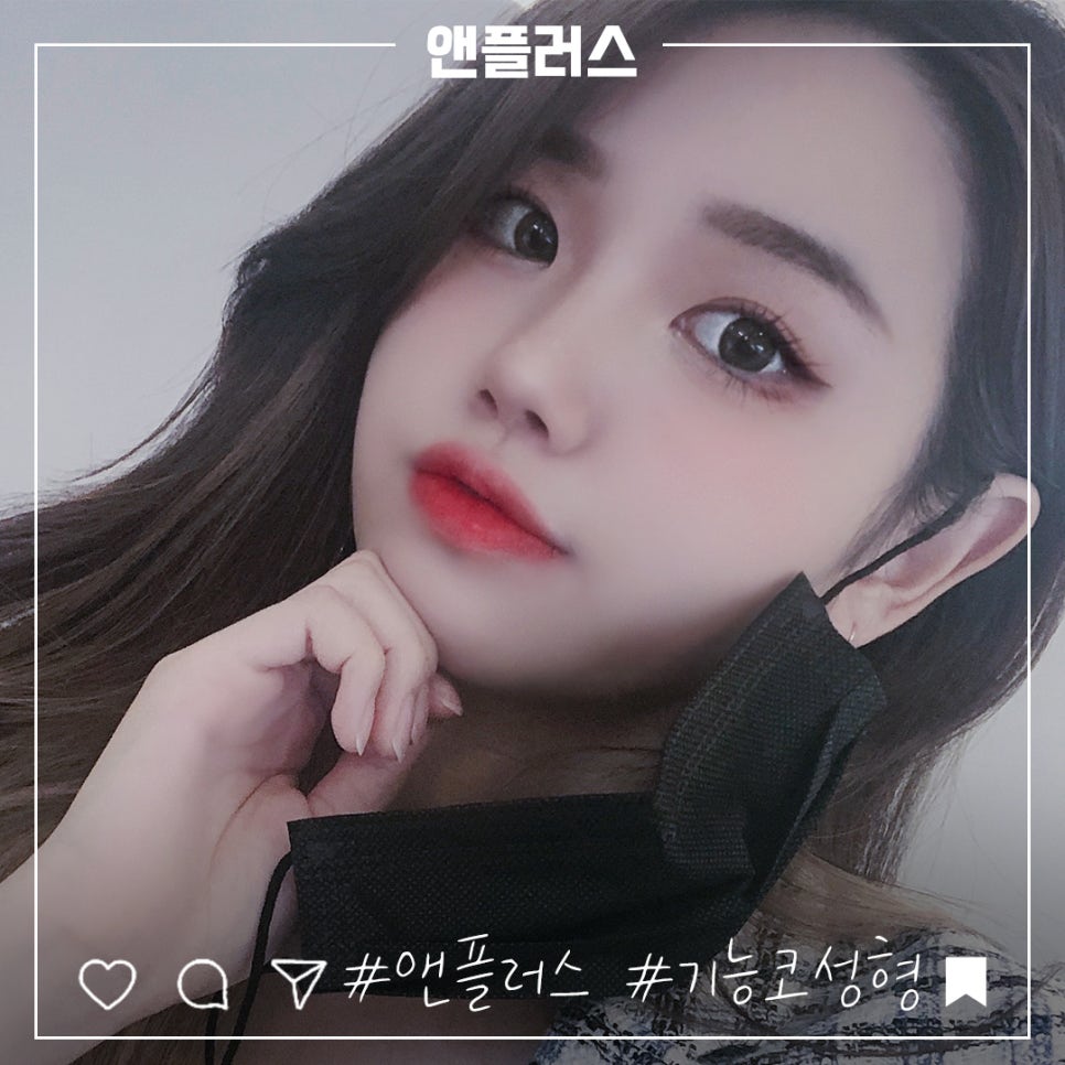코성형후기 만족스러운 결과 관련 이미지 1