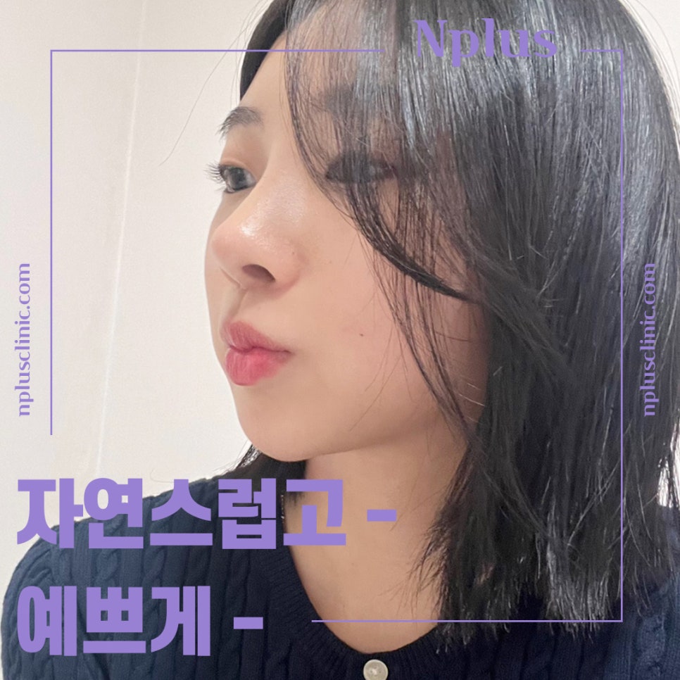 압구정코수술에 대해 찾아보고 관련 이미지 6