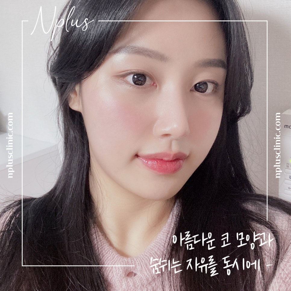 콧볼축소후기 원인을 정확하게 알아보고 관련 이미지 3