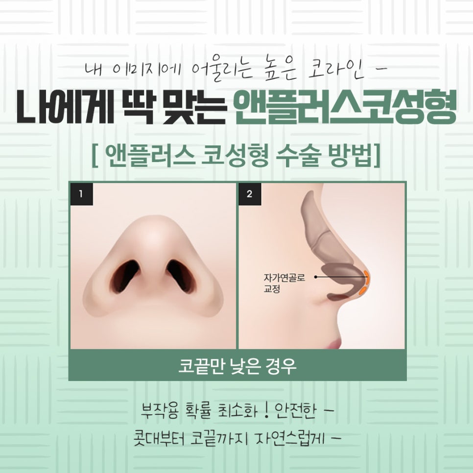 Check the Difference in Autologous Rib Nose Surgery Results image 10