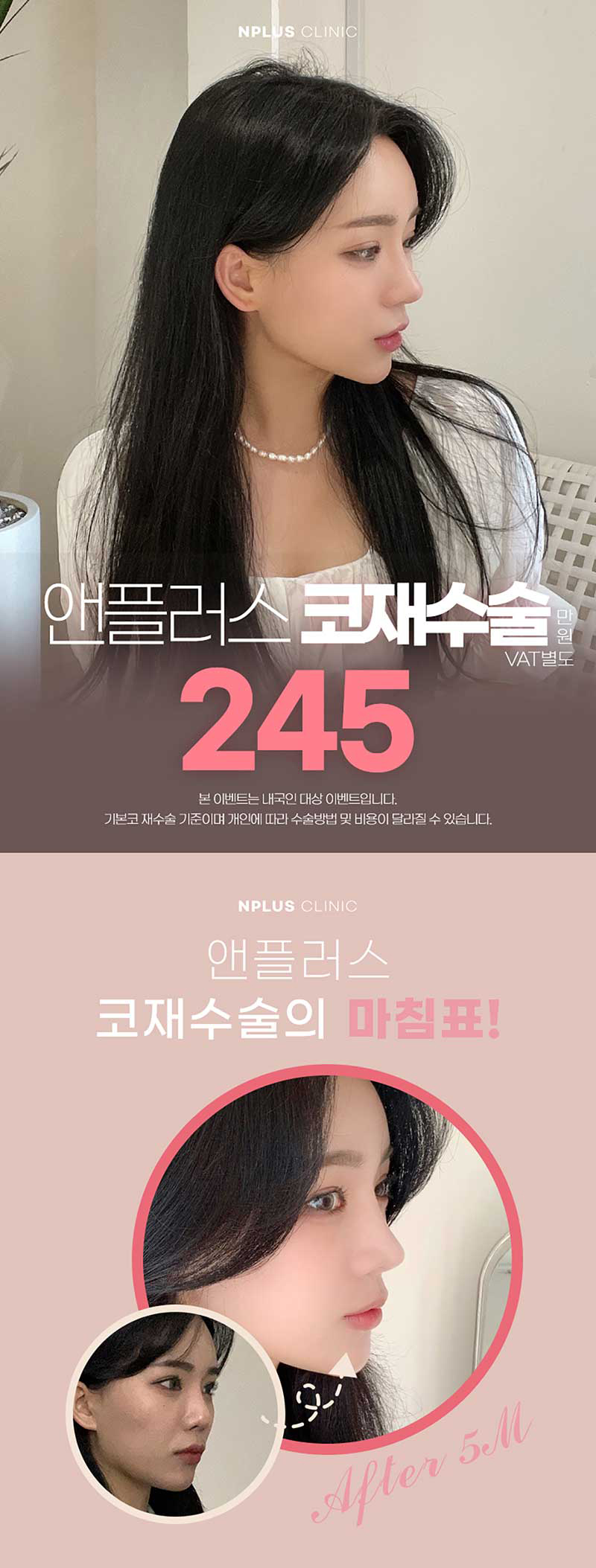 앤플러스의원 코재수술이벤트로 자연스럽고 예쁘게- 관련 이미지 2