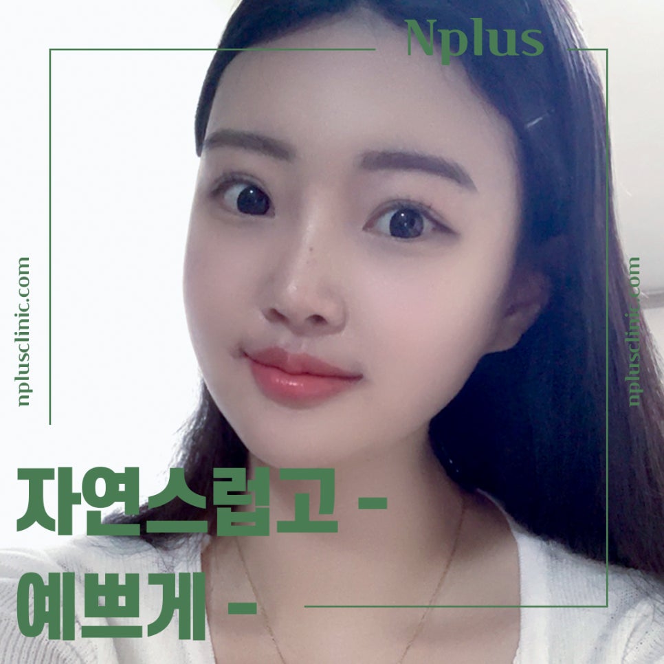 Nose Surgery Review Using Autologous Cartilage image 4