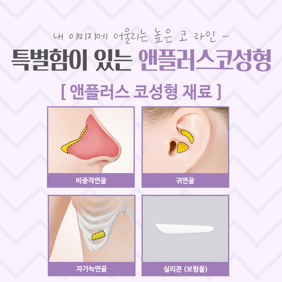 코수술후기를 통해 내게 어울리는 라인으로 관련 이미지 10