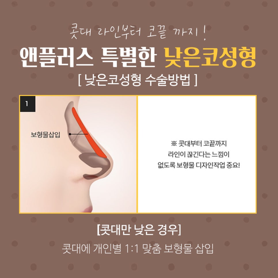 낮은코성형후기 세련된 이미지로 관련 이미지 9