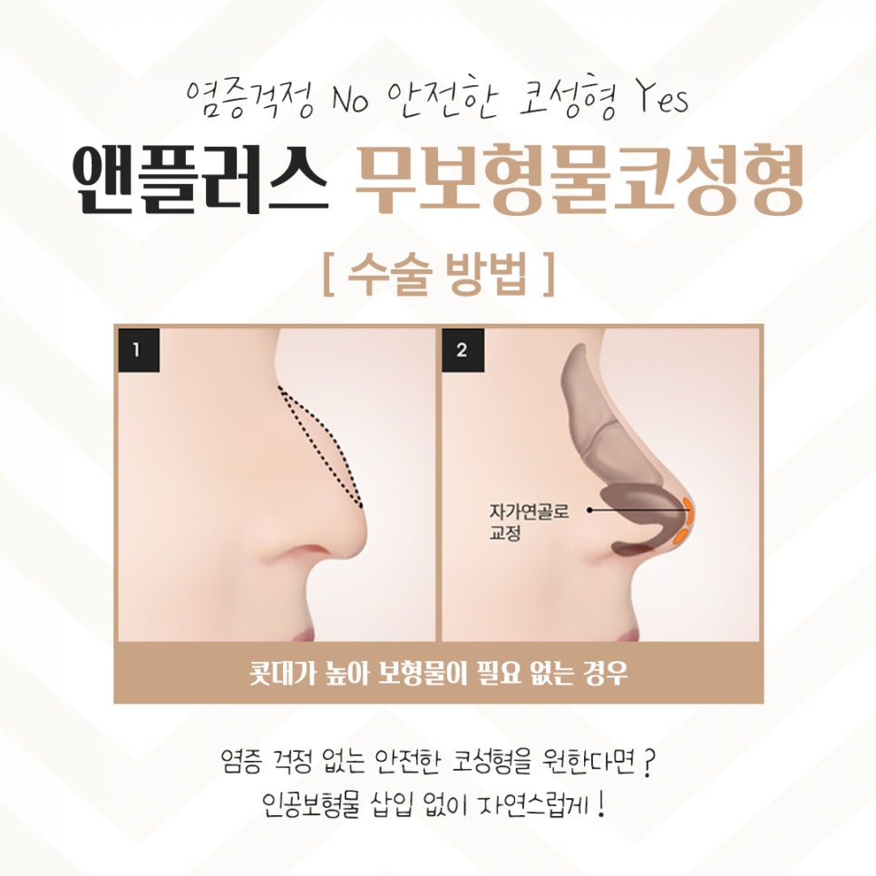 If You’re Looking for Reviews of Non-Implant Nose Surgery image 7