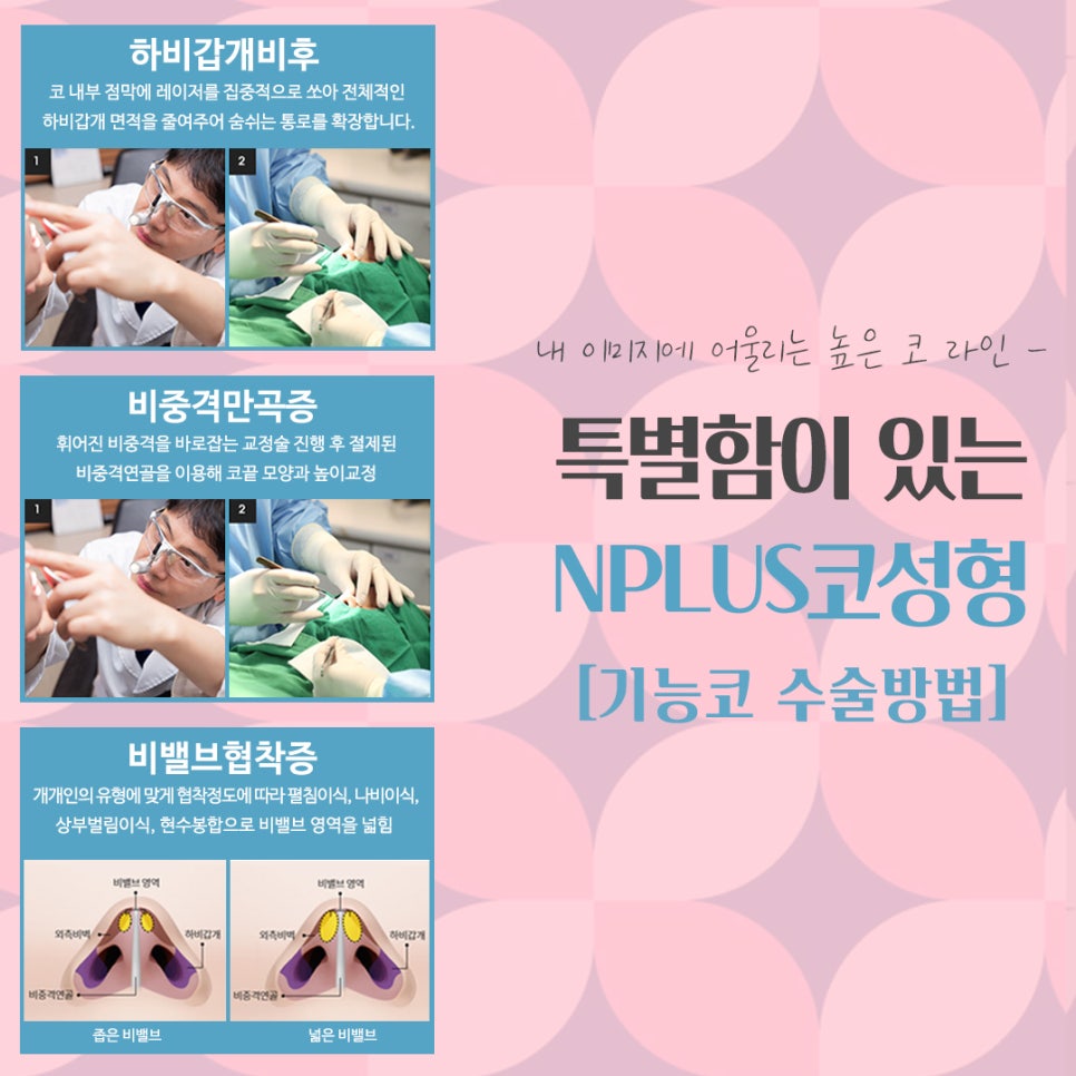 Nose Surgery Review with a Natural Nose Line image 12
