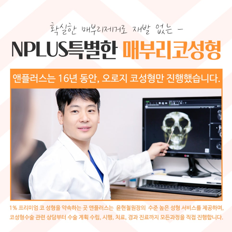 Hump Nose Surgery Review with a Clear Diagnosis image 7