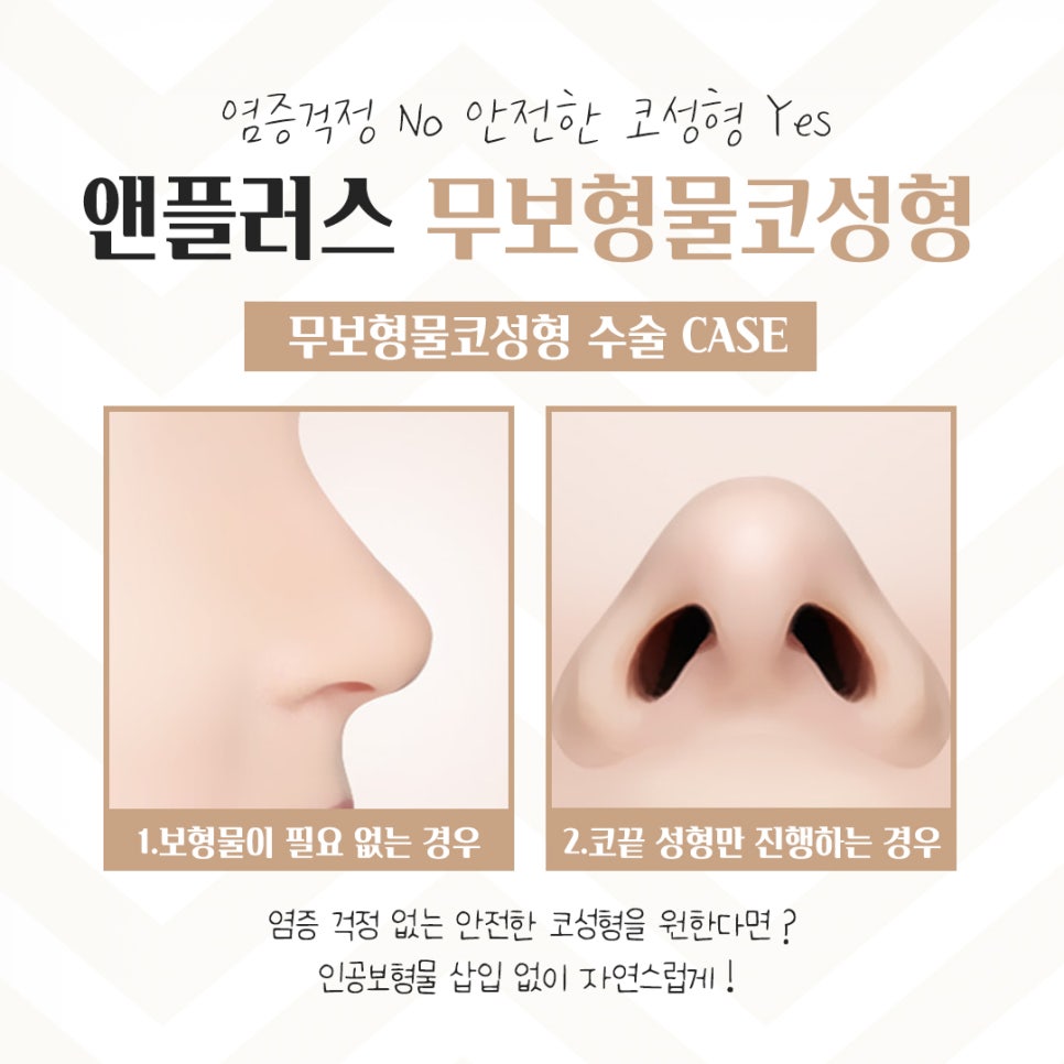 If You’re Looking for Reviews of Non-Implant Nose Surgery image 6