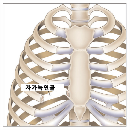 Check Whether a Non-Implant Rhinoplasty Is Possible in Your Case! image 3