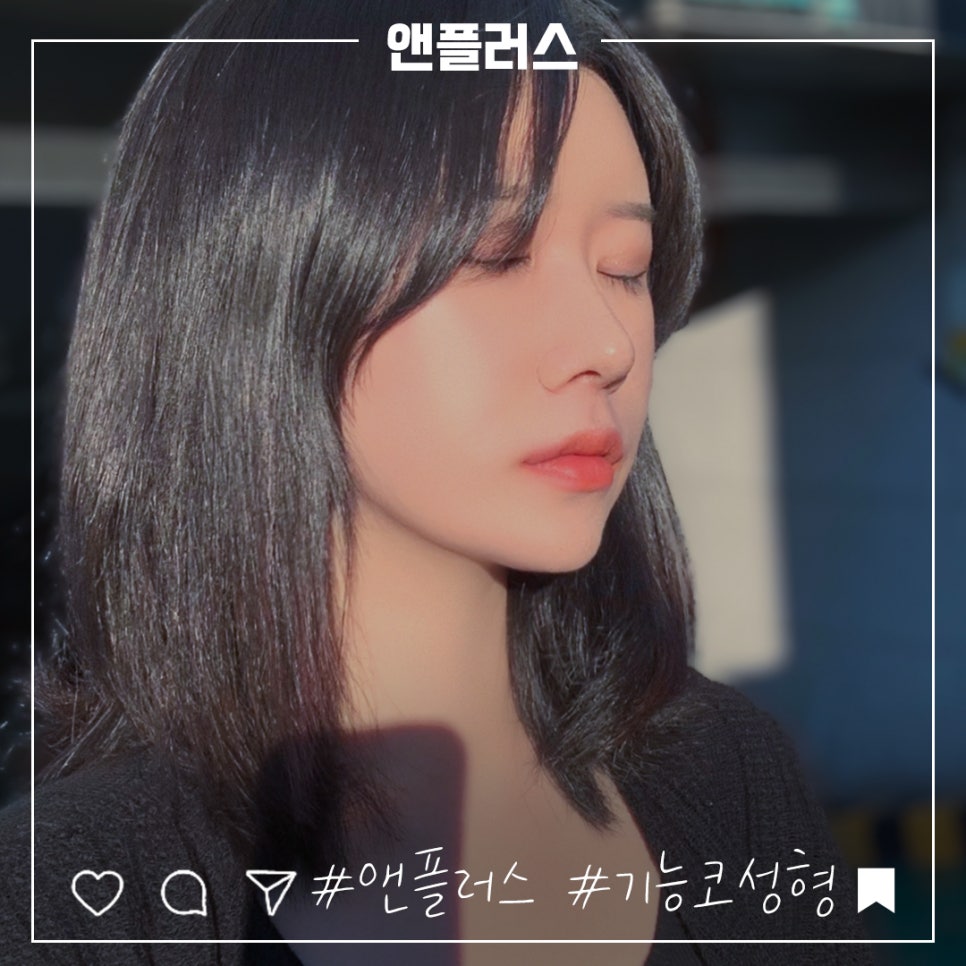 코성형후기 자연스럽고 예쁘게 관련 이미지 2