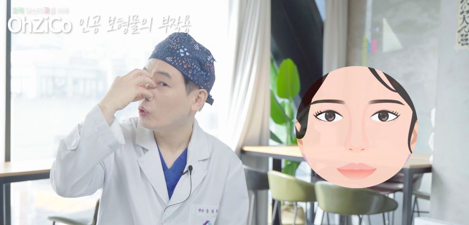 Everything About the Implants Used in Nasal Bridge Surgery image 8