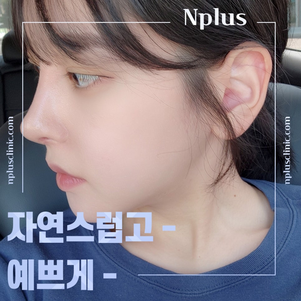기능코성형 후기 보고 비교하여 관련 이미지 1