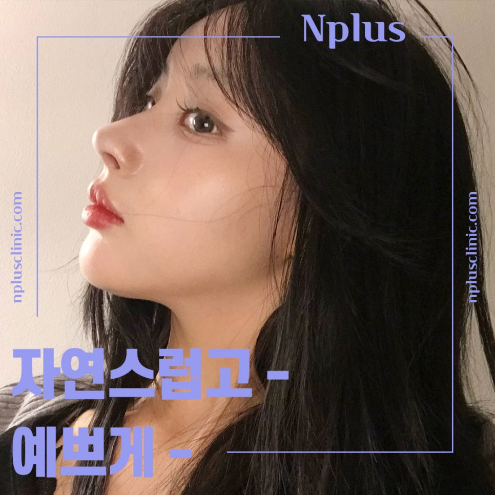복코수술전후에 대해 자세히 찾아보고 관련 이미지 3