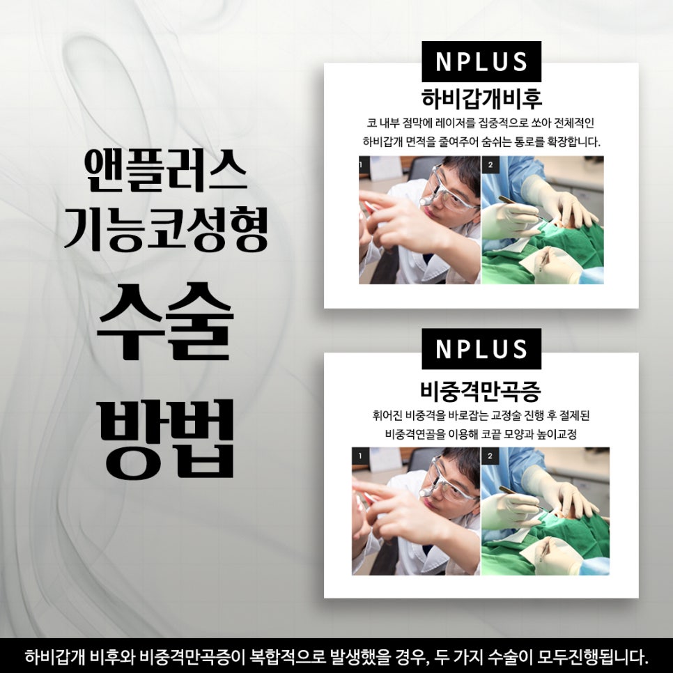 기능코성형실비에 대해 체크하고 관련 이미지 10