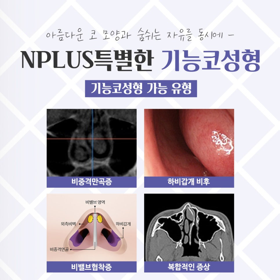 기능코수술후기 잘 알아보고 선택 관련 이미지 5