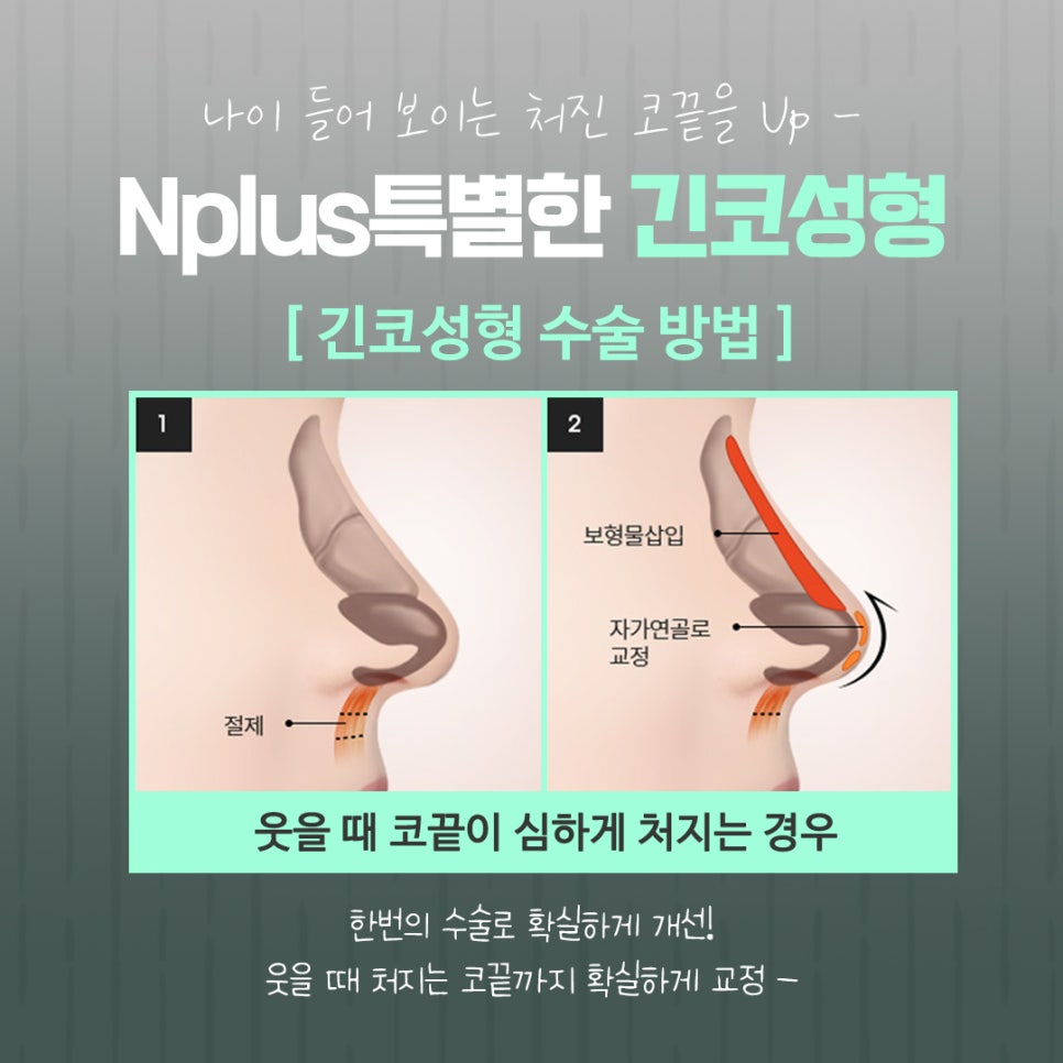 긴코수술을 통해 동안으로 관련 이미지 11