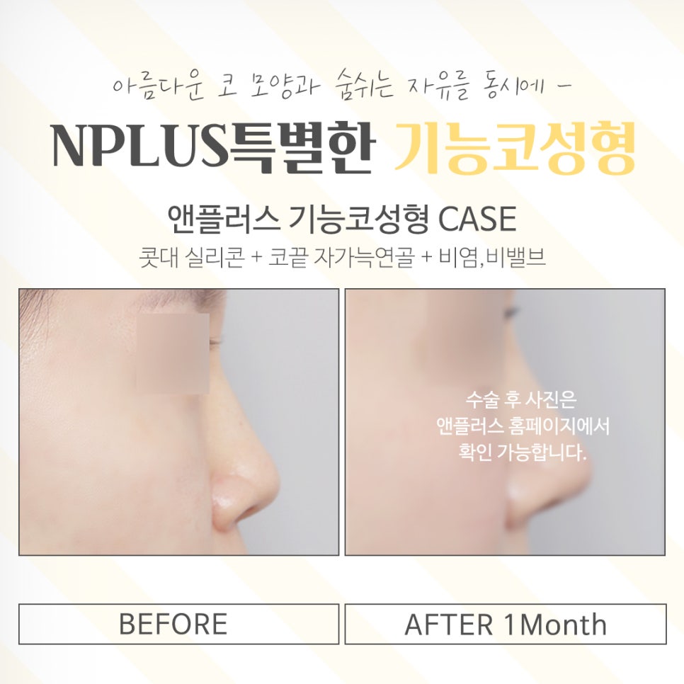 If You’re Looking for Functional Nose Surgery Reviews image 14