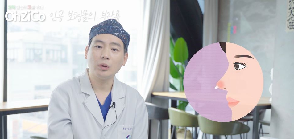 Everything About the Implants Used in Nasal Bridge Surgery image 10
