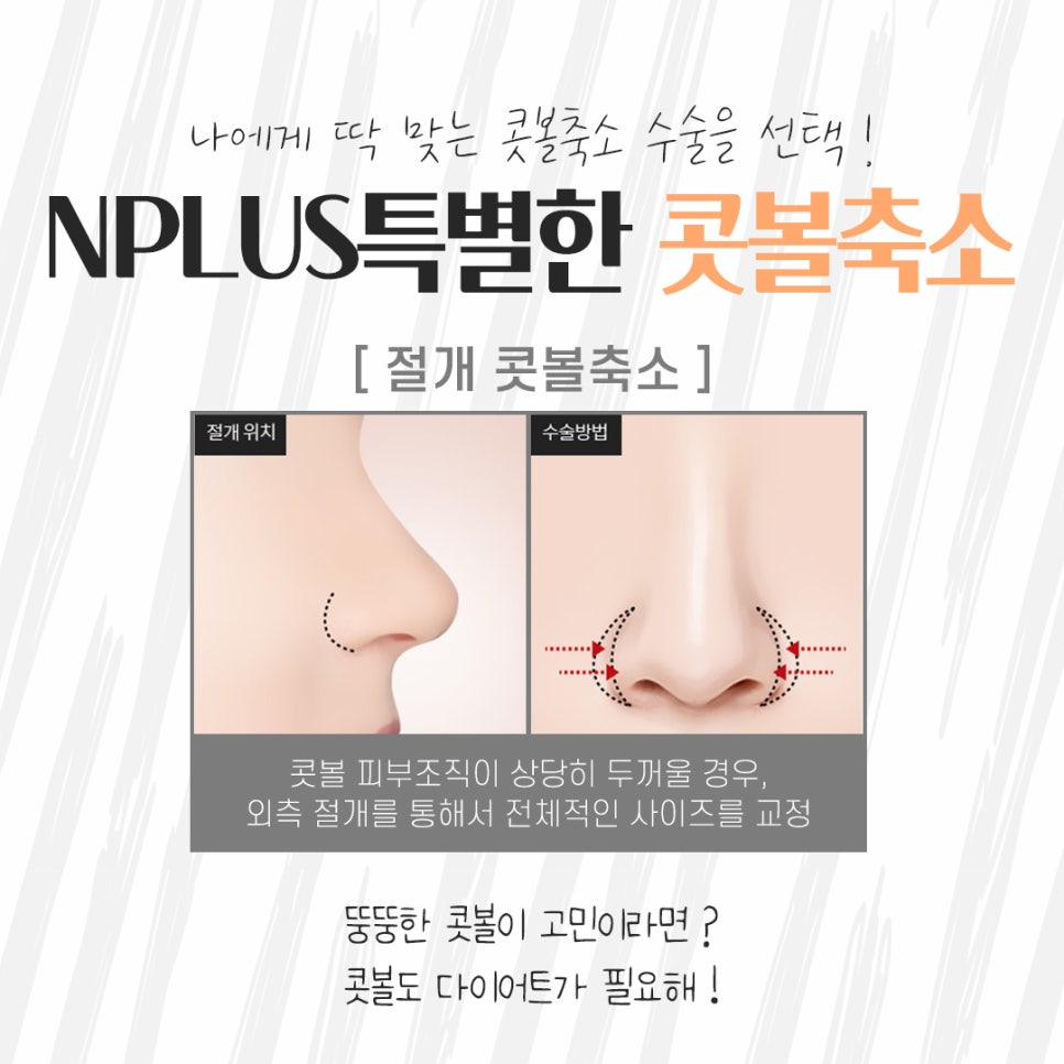 Looking into Nasal Ala Reduction Surgery Methods image 10