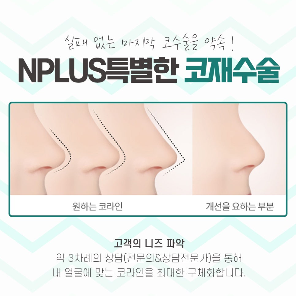 Male Nose Revision Surgery with a Thorough Diagnosis image 13