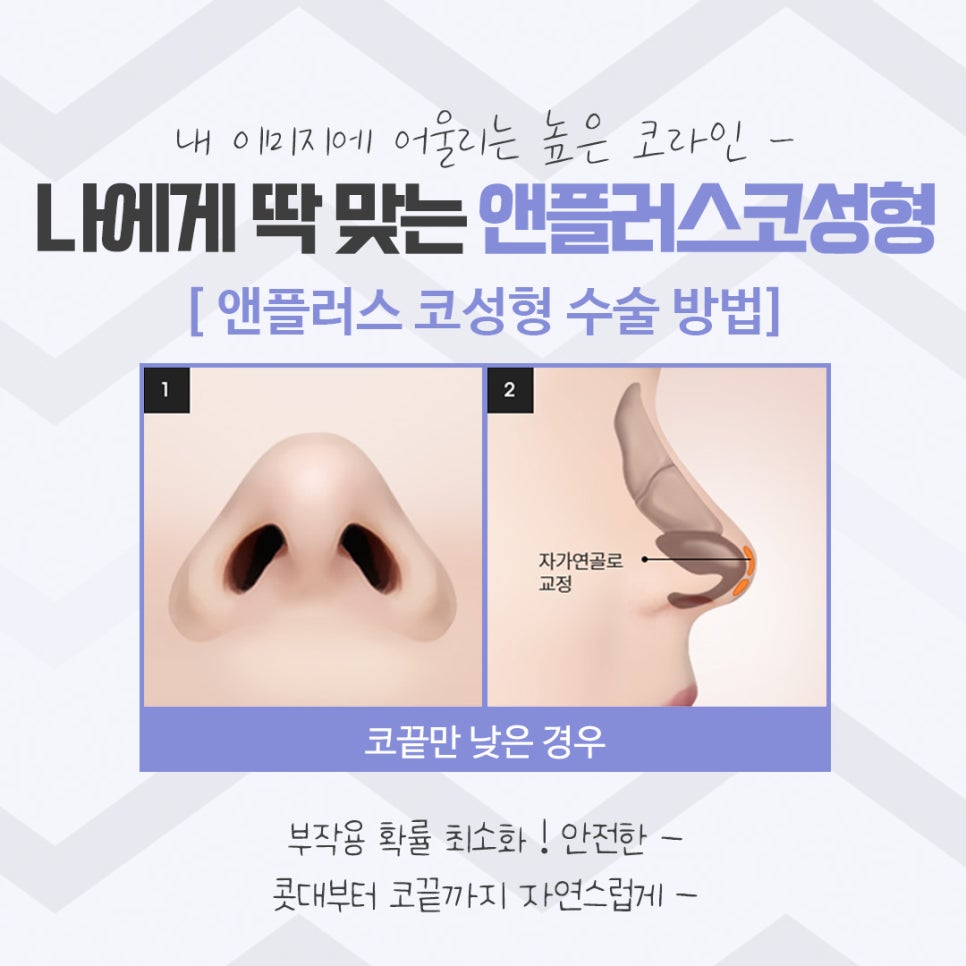 코성형후기 이미지를 예쁘고 자연스럽게 관련 이미지 10