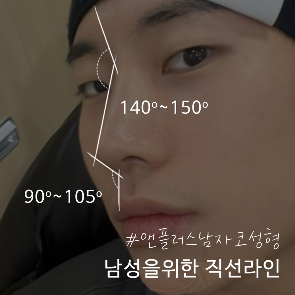 남자코성형후기 기능에 대해 알아보고 관련 이미지 2